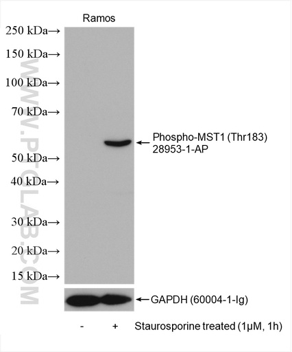 [28953-1-AP-100UL] Phospho-STK4 (Thr183) Polyclonal antibody