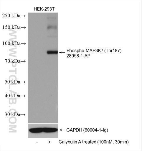 [28958-1-AP-20UL] Phospho-MAP3K7 (Thr187) Polyclonal antibody