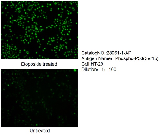 [28961-1-AP-20UL] Phospho-P53 (Ser15) Polyclonal antibody