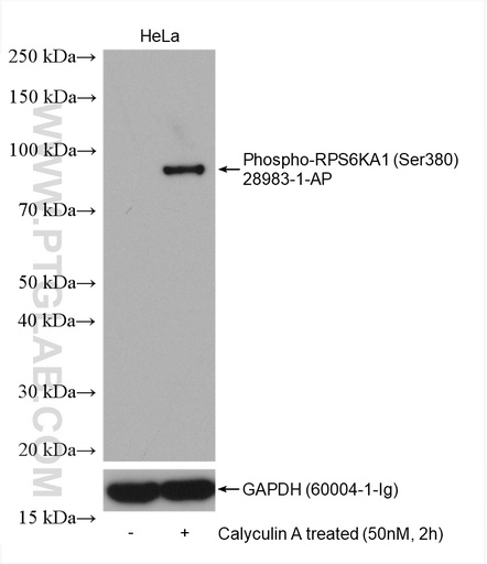 [28983-1-AP-20UL] Phospho-RPS6KA1 (Ser380) Polyclonal antibody