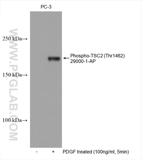 [29000-1-AP-20UL] Phospho-TSC2 (Thr1462) Polyclonal antibody