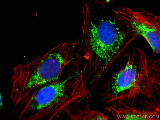 [29087-1-AP-20UL] TRMT10C Polyclonal antibody