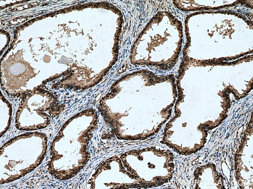 [29092-1-AP-20UL] RPL5 Polyclonal antibody