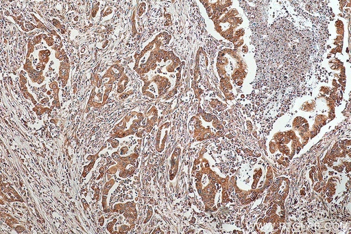[29115-1-AP-150UL] PTH1R Polyclonal antibody