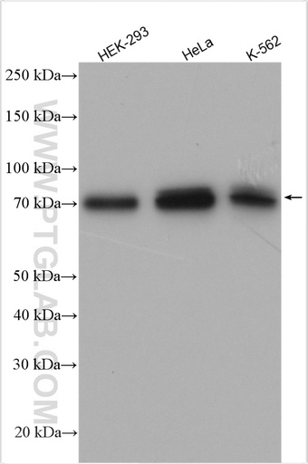[29167-1-AP-150UL] MAP3K7 Polyclonal antibody