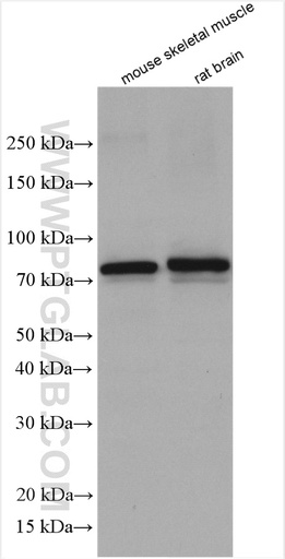 [29169-1-AP-150UL] PADI2 Polyclonal antibody