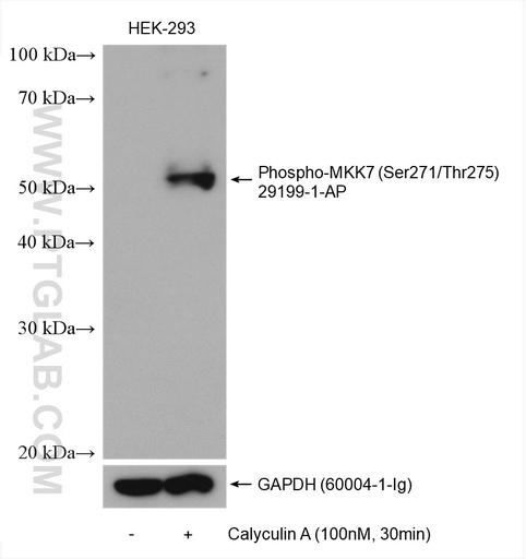 [29199-1-AP-100UL] Phospho-MAP2K7 (Ser271/Thr275) Polyclonal antibody