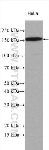 [29206-1-AP-20UL] DSG2 Polyclonal antibody