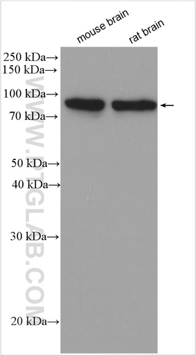 [29208-1-AP-150UL] PKC Gamma Polyclonal antibody