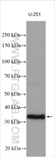 [29213-1-AP-20UL] TYW3 Polyclonal antibody