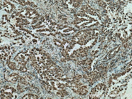 [29219-1-AP-150UL] CBLL1 Polyclonal antibody