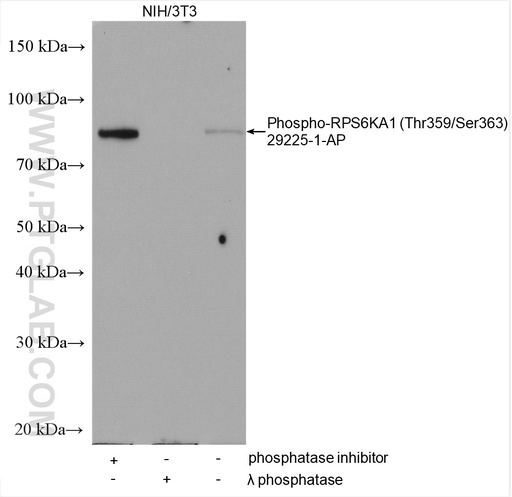 [29225-1-AP-100UL] Phospho-RPS6KA1 (Thr359/Ser363) Polyclonal antibody