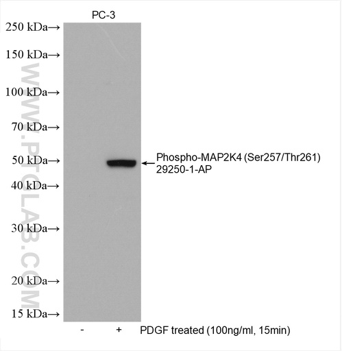 [29250-1-AP-20UL] Phospho-MAP2K4 (Ser257/Thr261) Polyclonal antibody