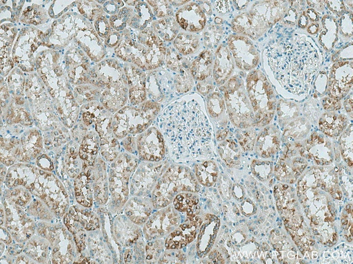 [29259-1-AP-20UL] HEXA Polyclonal antibody