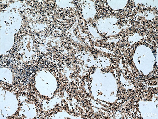[29270-1-AP-20UL] TMEM41B Polyclonal antibody