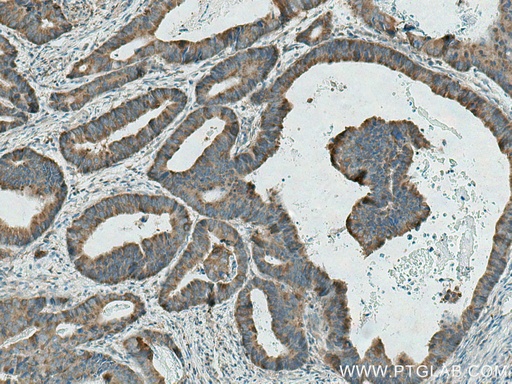 [29272-1-AP-20UL] GAB2 Polyclonal antibody