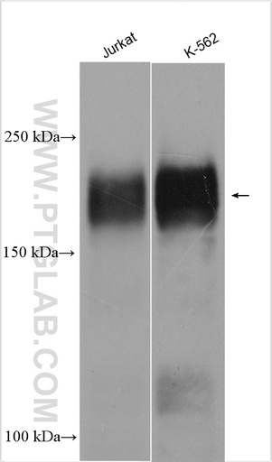 [29278-1-AP-150UL] MLL Polyclonal antibody