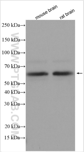 [29288-1-AP-150UL] DLK1 Polyclonal antibody