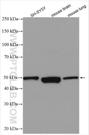 [29318-1-AP-20UL] S1PR1 Polyclonal antibody