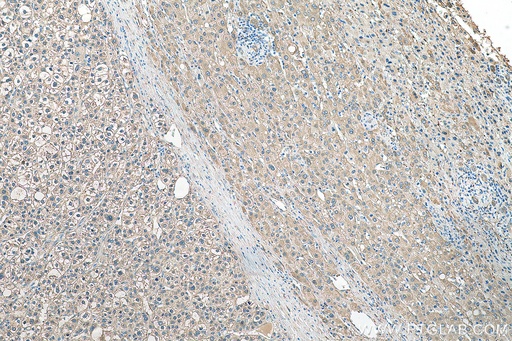 [29373-1-AP-150UL] ALDH1A3 Polyclonal antibody