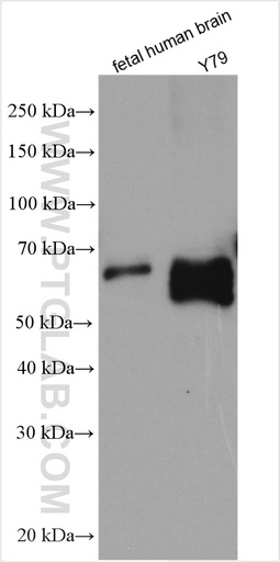 [29395-1-AP-20UL] SOX11 Polyclonal antibody