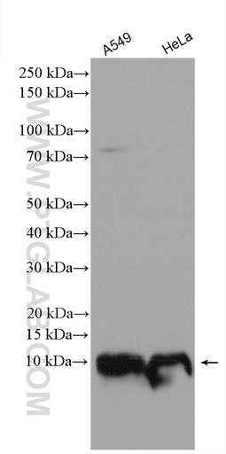 [29402-1-AP-20UL] IER3IP1 Polyclonal antibody