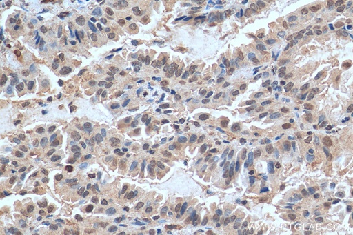 [29407-1-AP-150UL] FAM111B Polyclonal antibody