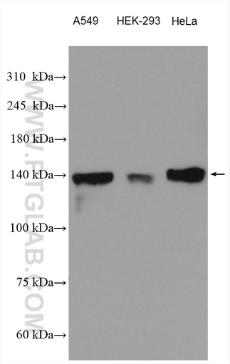 [29415-1-AP-20UL] PTPRS Polyclonal antibody