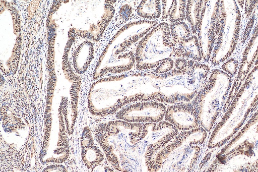 [29441-1-AP-150UL] YTHDC1 Polyclonal antibody
