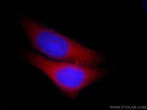 [51002-1-AP-20UL] IST1 Polyclonal antibody