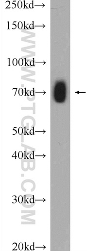 [51004-1-AP-20UL] GEFT Polyclonal antibody