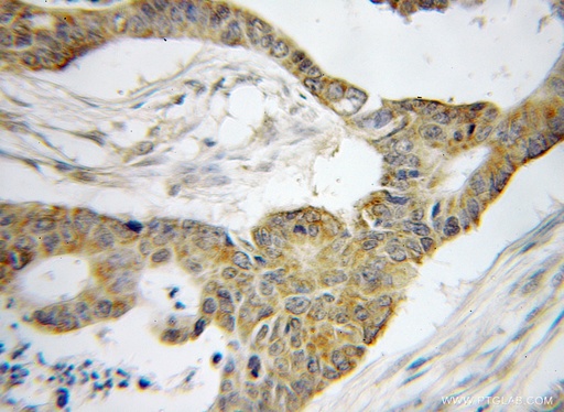 [51009-2-AP-150UL] BRD7 Polyclonal antibody