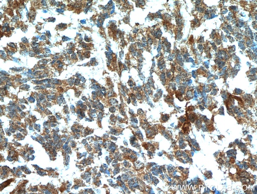 [51010-1-AP-20UL] FABP7 Polyclonal antibody