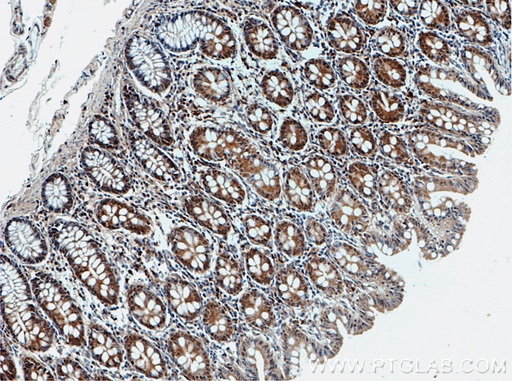 [51012-2-AP-150UL] SPTLC2 Polyclonal antibody