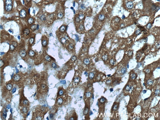 [51013-2-AP-150UL] GRHPR Polyclonal antibody