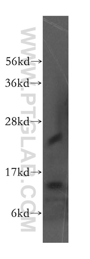 [51014-2-AP-20UL] Evi2a Polyclonal antibody
