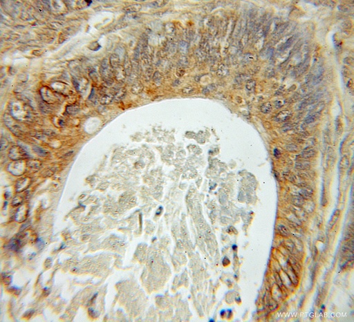 [51015-1-AP-150UL] Fhl1 Polyclonal antibody