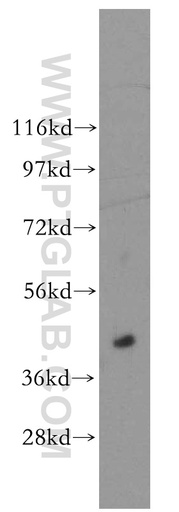 [51016-2-AP-20UL] ACOT7L Polyclonal antibody