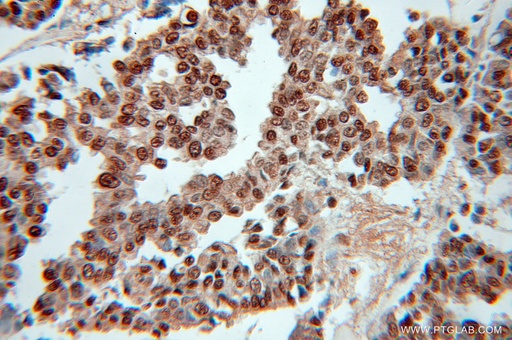 [51019-2-AP-20UL] RPLP0 Polyclonal antibody