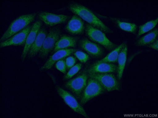 [51020-2-AP-20UL] SEC61B Polyclonal antibody