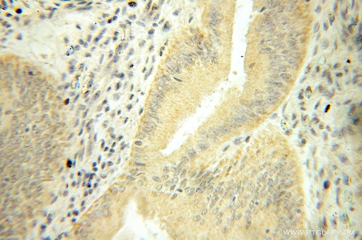 [51025-2-IG-150UL] Mecr Polyclonal antibody