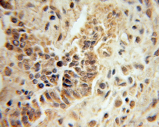 [51027-2-AP-150UL] Mecr Polyclonal antibody