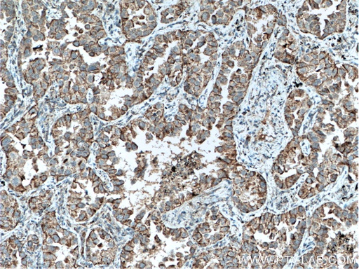 [51031-1-AP-20UL] SLC25A6 Polyclonal antibody