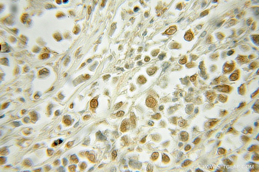 [51033-1-AP-20UL] RAD23A Polyclonal antibody