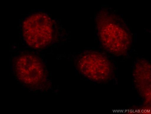 [51034-1-AP-150UL] HSF1 Polyclonal antibody