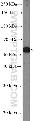 [51036-2-AP-150UL] PAX3 Polyclonal antibody