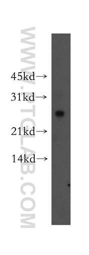 [51037-2-AP-20UL] Connexin-26 Polyclonal antibody