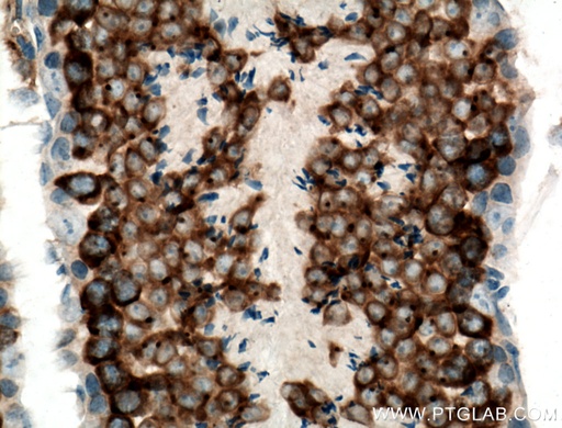 [51042-1-AP-20UL] DDX4,VASA Polyclonal antibody