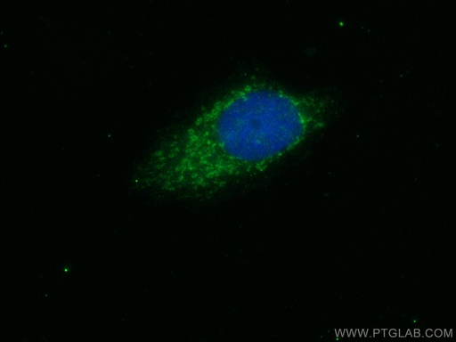 [51045-1-AP-150UL] SIK1 Polyclonal antibody