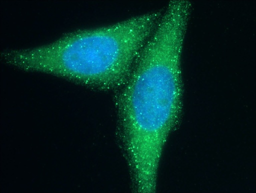 [51046-1-AP-150UL] Cd2ap Polyclonal antibody